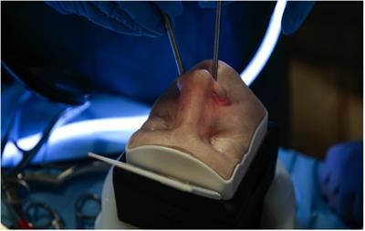 High fidelity simulation of the endoscopic transsphenoidal approach: Validation of the UpSurgeOn TNS Box